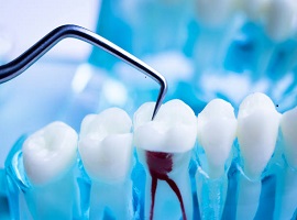 Best Endodontists In Ahmedabad